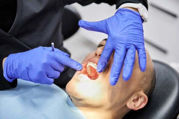 Best Emergency Tooth Extraction in West Livingston, TX